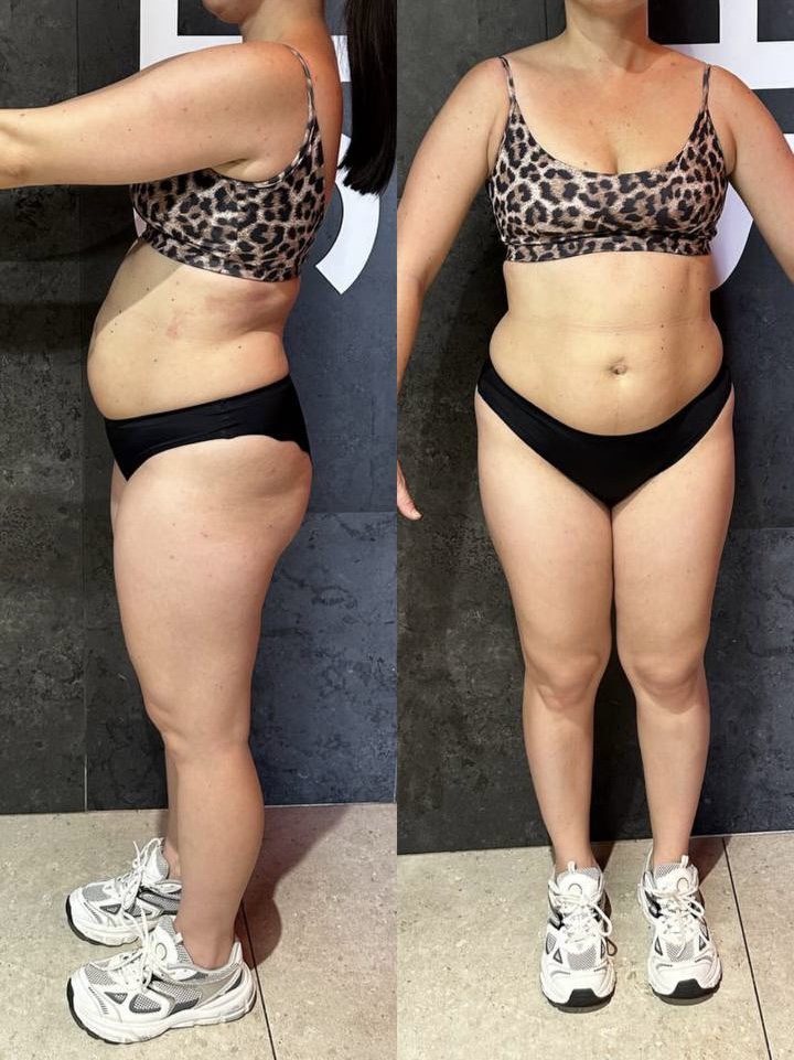 После — результат клиентки