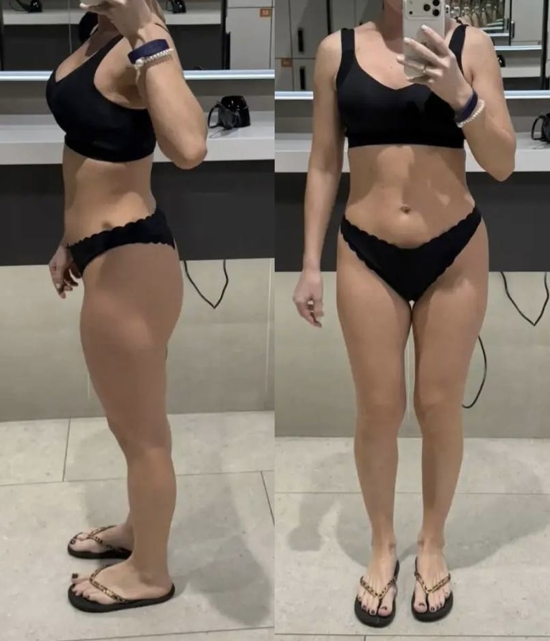 До — результат клиентки